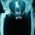 bad-moment-for-x-rays02